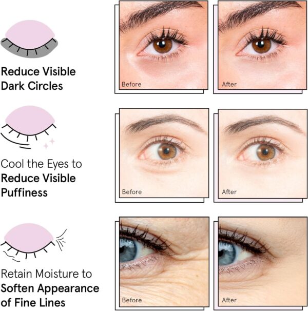 Grace & Stella Under Eye Patches, Christmas Gifts for Women (12 Pairs) Christmas Gifts for Mom, Eye Patches for Puffy Eyes and Dark Circles, Vegan Eye Mask, Birthday Gifts for Women, Stocking Stuffers - Image 5