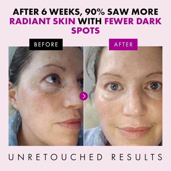 Collagen Anti Aging Face Cream with Patented Matrixyl-3000 & Argireline - 5x More Powerful w/ Pep-Boost Peptide Complex + 10 Antioxidants - Facial Wrinkle Day/Night Cream Face Moisturizer for Women - Image 6