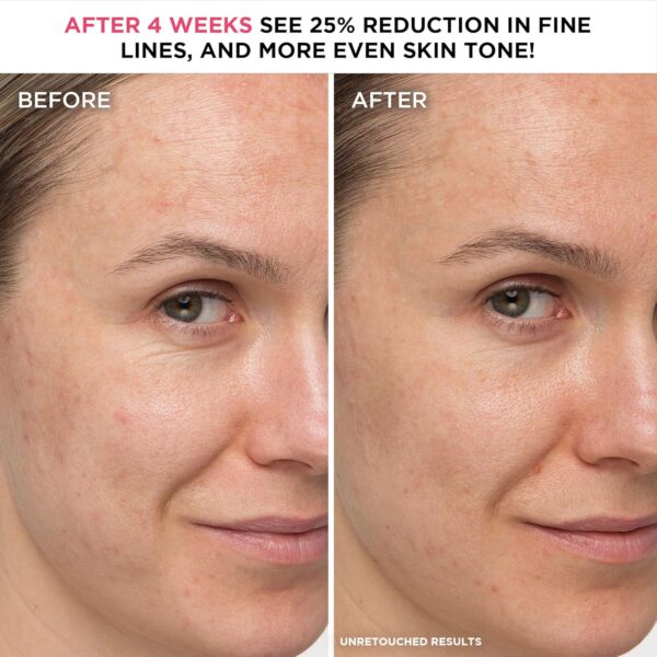 IT Cosmetics Confidence in a Cream Anti Aging Face Moisturizer – Visibly Reduces Fine Lines, Wrinkles & Signs of Aging Skin in 2 Weeks, 48HR Hydration with Hyaluronic Acid, Niacinamide - Image 3